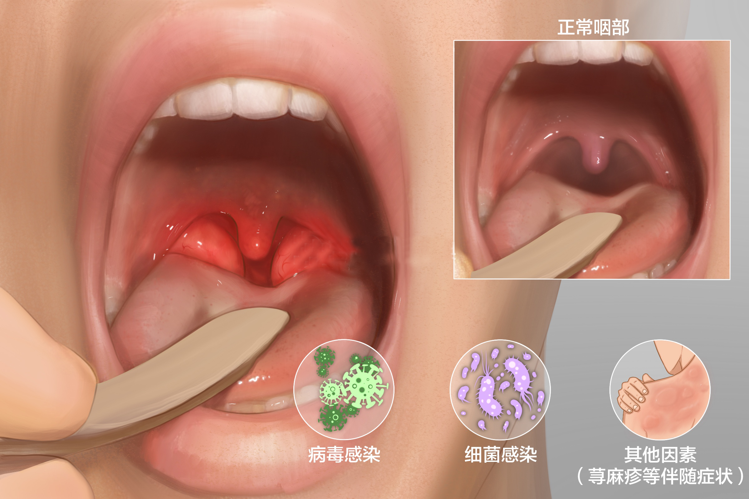 重庆治疗耳鼻喉的医院